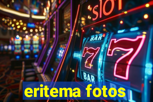 eritema fotos